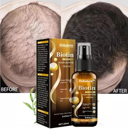 Dobshow™Biotin Premium Hair Growth Serum